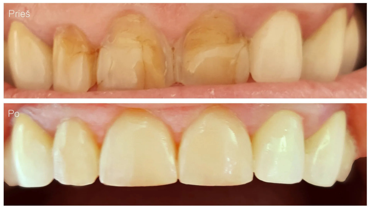 Profident, odontologijos klinika, UAB