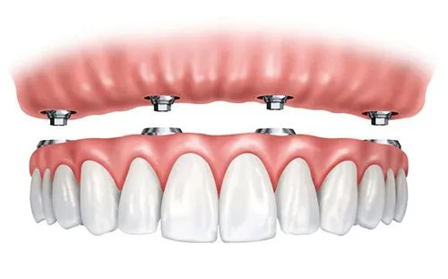 Profident, odontologijos klinika, UAB