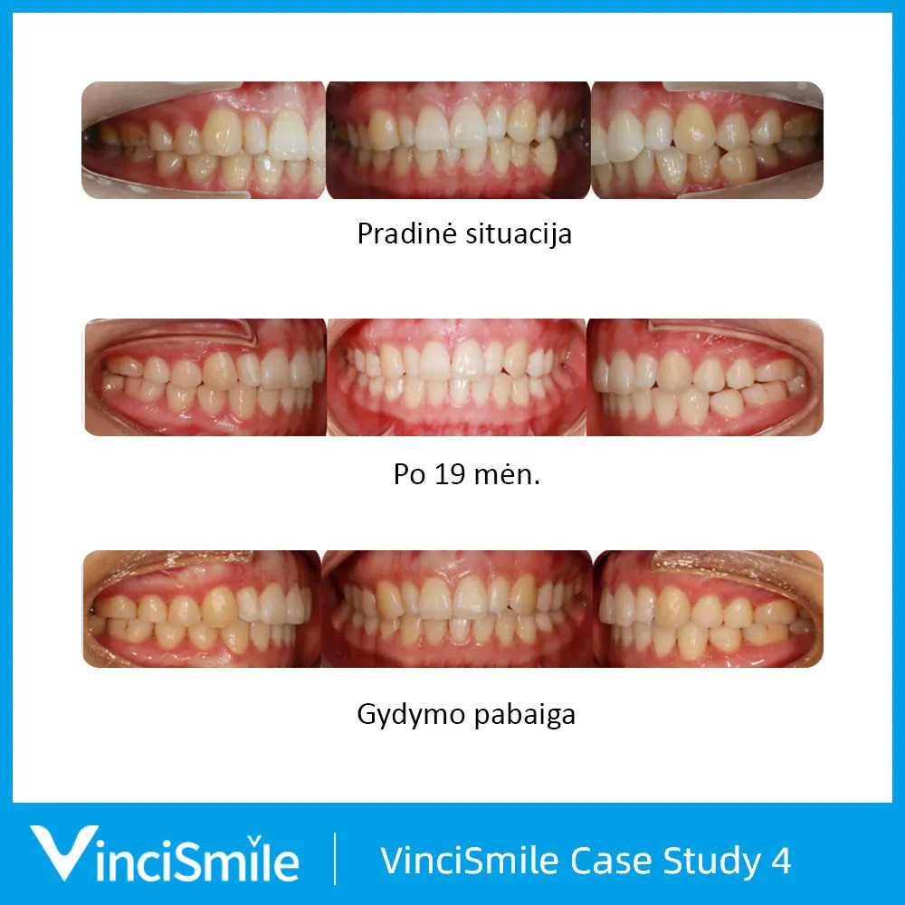 VinciSmile, UAB ,,Odontologijos reikmenys"