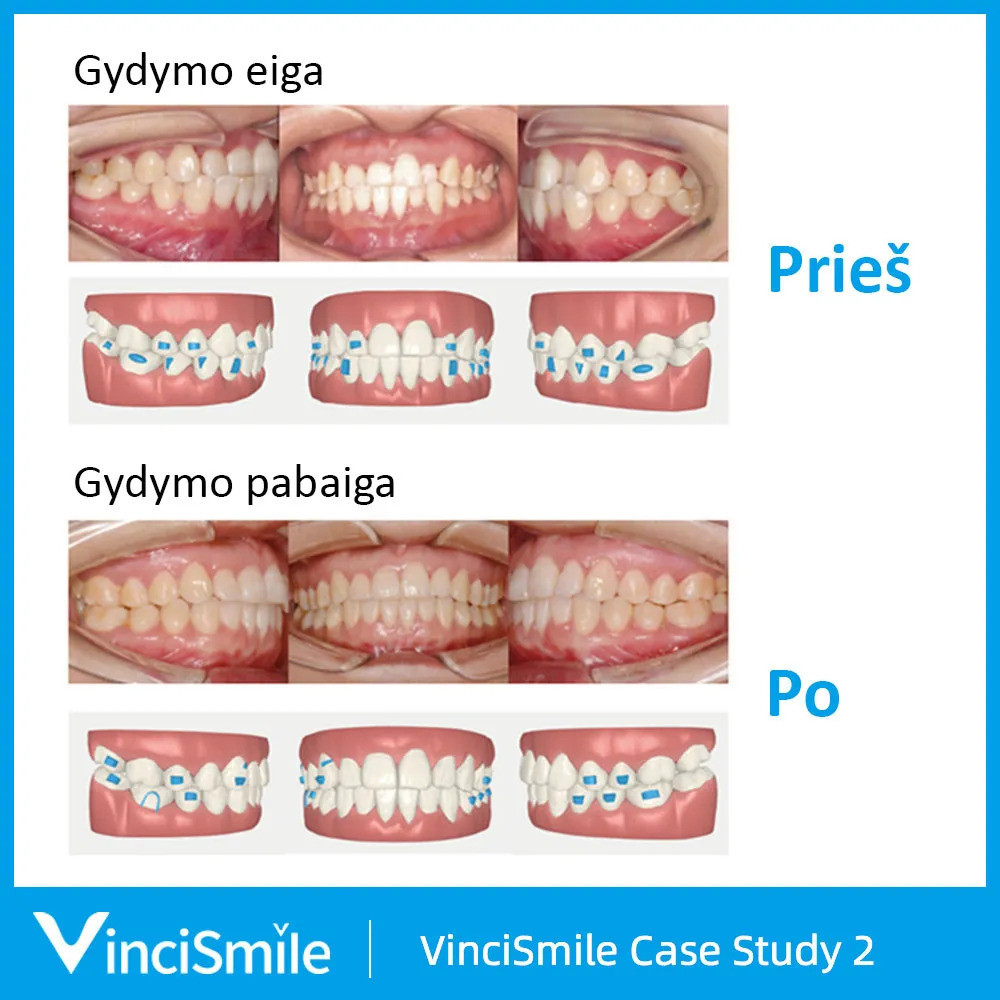 VinciSmile, UAB ,,Odontologijos reikmenys"