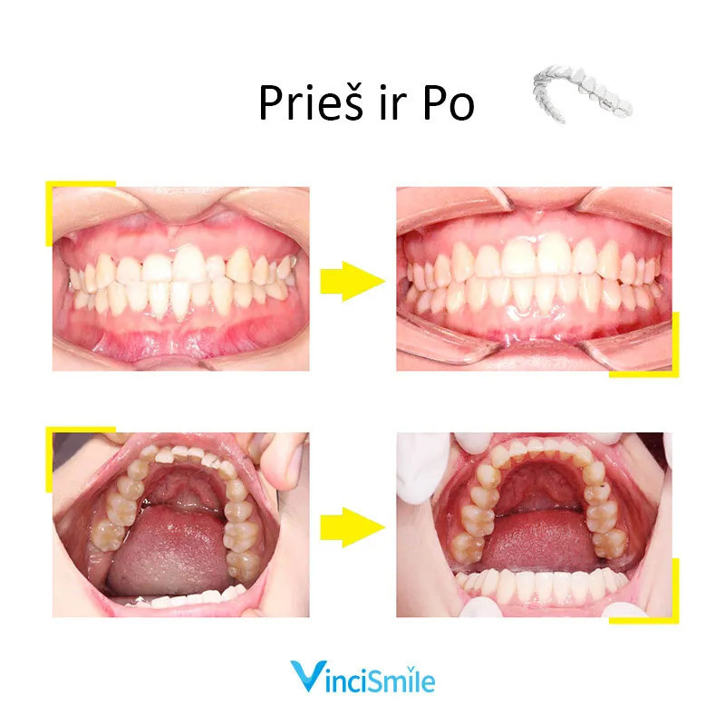 VinciSmile, UAB ,,Odontologijos reikmenys"