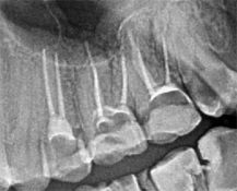 Endodontija