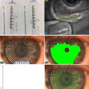 Sausų akių diagnostika
